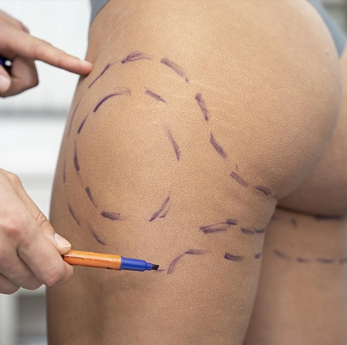 close-up-hand-drawing-patient-s-body copiar